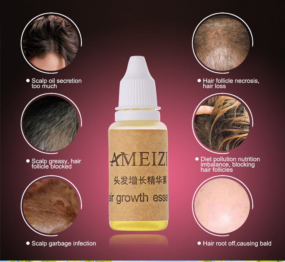 Hair Growth anti Hair Loss Liquid 20ml - 24 Timmar Deals