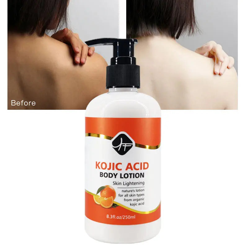 Kojic Acid Body Lotion 250ml