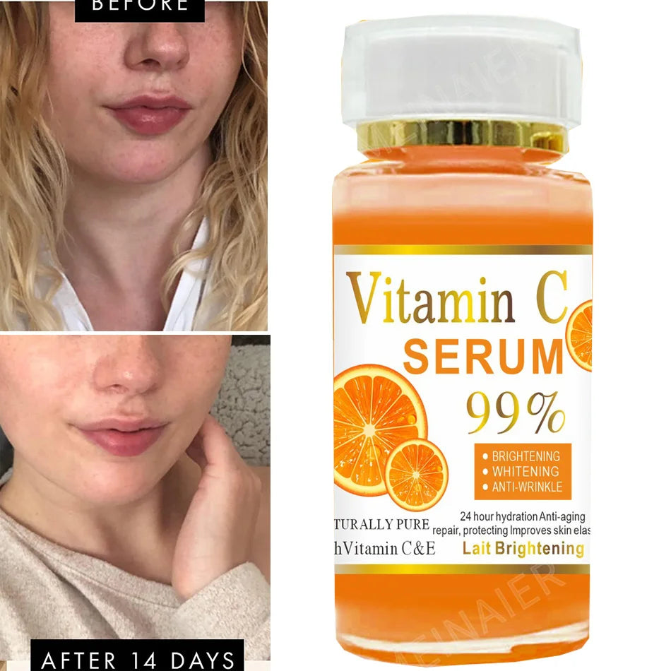 120ml 99% Vitamin C Serum Oil Facial Serum AHA Kojic Acid glutathione Facial skin brightening - 24 Timmar Deals