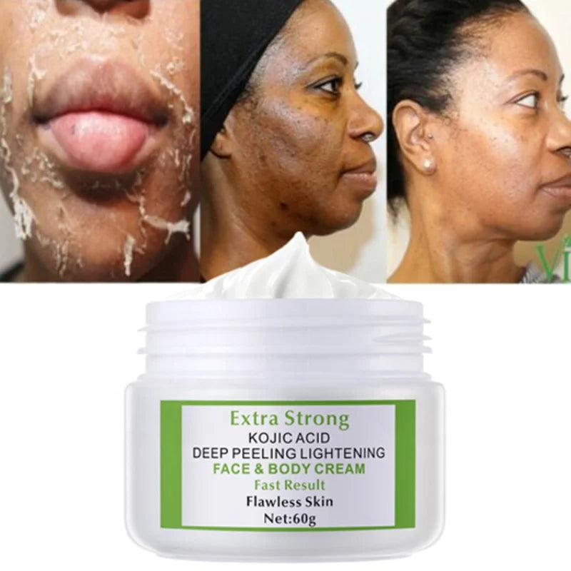 Extra Strong Kojic Acid 7days Lightening Peeling Body Face Cream 60g - 24 Timmar Deals