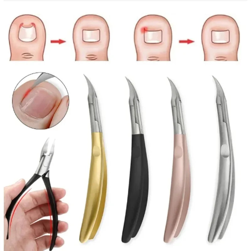 Nagelklippare Paronychia Nagelklippare - 24 Timmar Deals