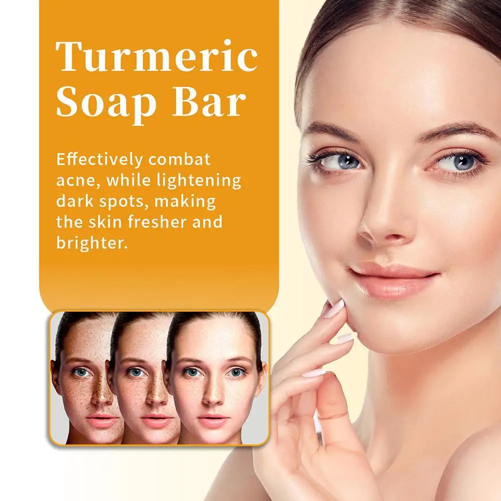 OUHOE Lemon Turmeric Kojic Acid Soap Bar Turmeric Face Whitening Body Oil Removal Soap Acne Skin Skin Care Care Body Soap A J2F1 - 24 Timmar Deals