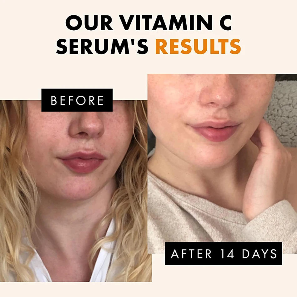 120ml 99% Vitamin C Serum Oil Facial Serum AHA Kojic Acid glutathione Facial skin brightening - 24 Timmar Deals