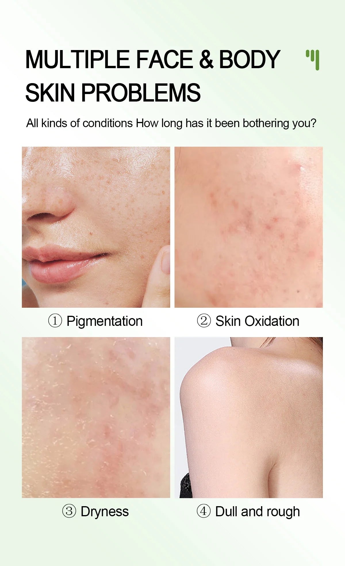 Extra Strong Kojic Acid 7days Lightening Peeling Body Face Cream 60g - 24 Timmar Deals