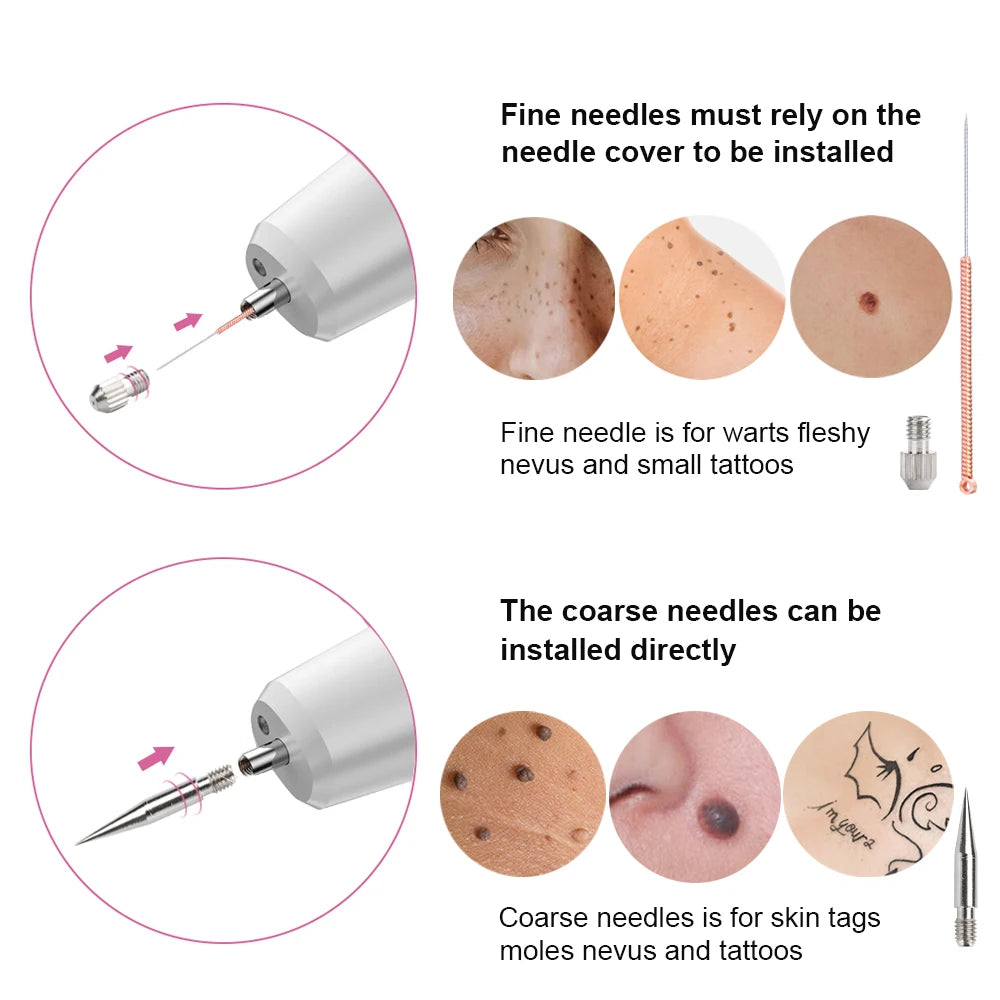 Skin Tag Remover Laser Plasma Pen Dark Spot Mole Wart Remover - 24 Timmar Deals