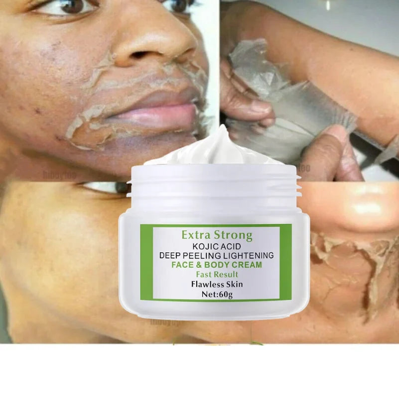Extra Strong Kojic Acid 7days Lightening Peeling Body Face Cream 60g - 24 Timmar Deals