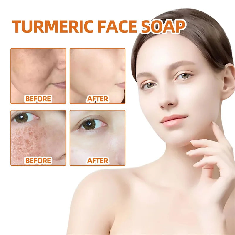 Kojic Acid Soap Handmade Whitening Soap Brightening skin Lighten Dark Spot Turmeric Soap Acne Scare Removal Cleaning Skin - 24 Timmar Deals