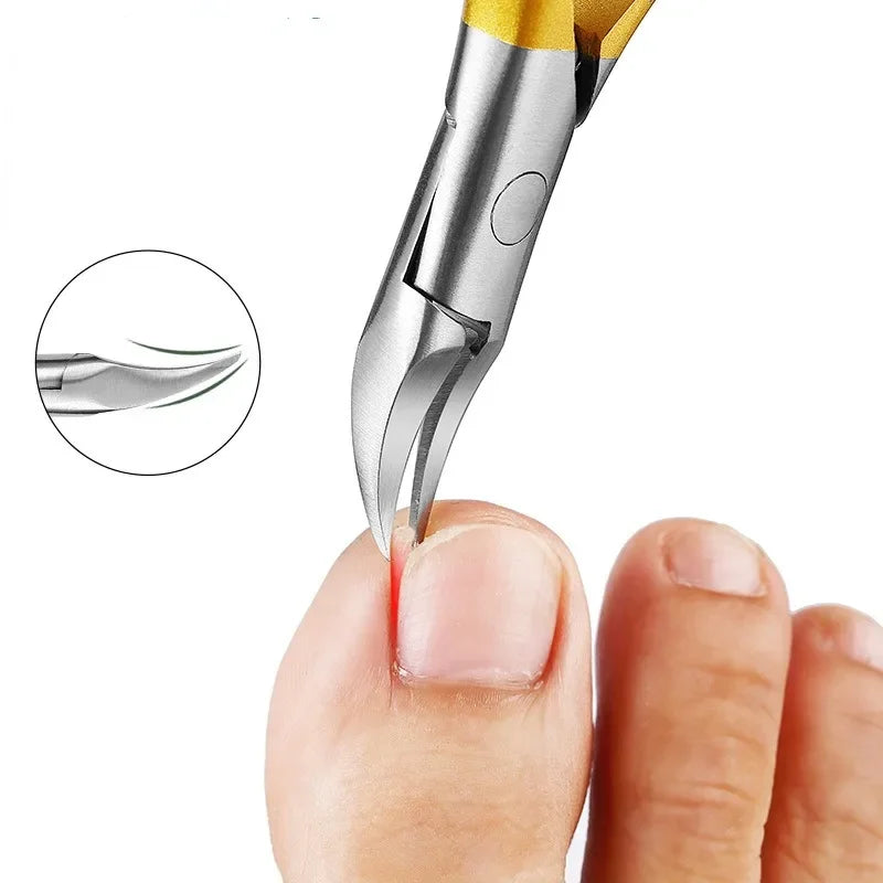 Nagelklippare Paronychia Nagelklippare - 24 Timmar Deals