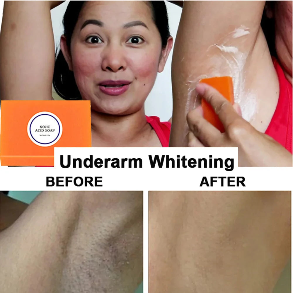 Kojic Acid Soap Handmade Whitening Skin Moisturizing Lightening Soap Glutathione Face Body Bleaching Cleaning Essential Oil Soap - 24 Timmar Deals
