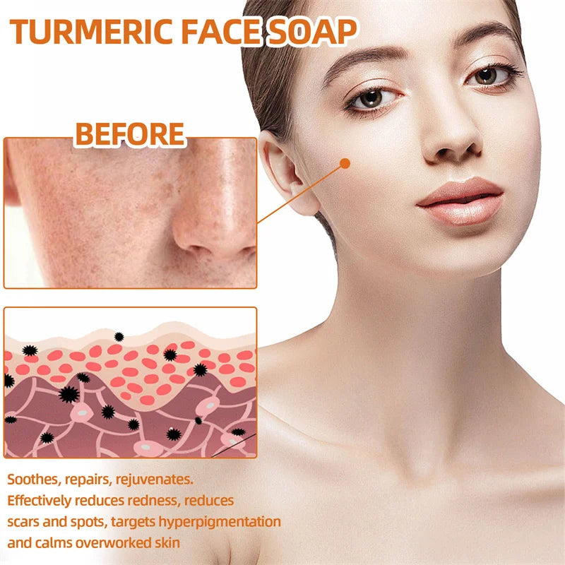 Kojic Acid Soap Handmade Whitening Soap Brightening skin Lighten Dark Spot Turmeric Soap Acne Scare Removal Cleaning Skin - 24 Timmar Deals
