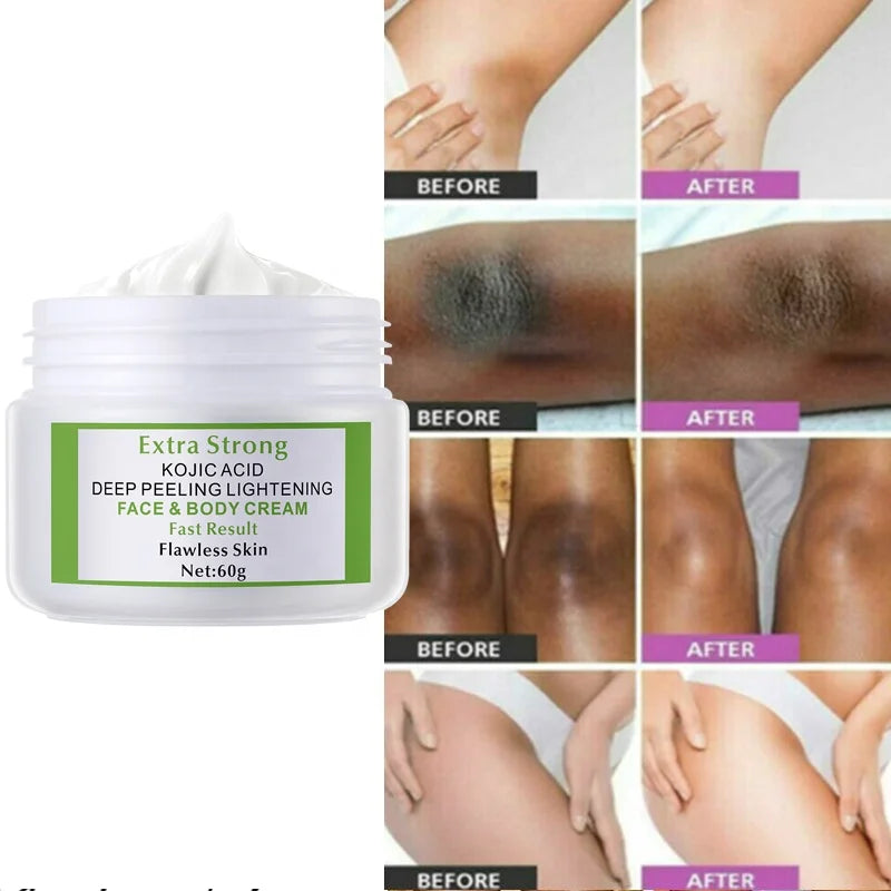 Extra Strong Kojic Acid 7days Lightening Peeling Body Face Cream 60g - 24 Timmar Deals