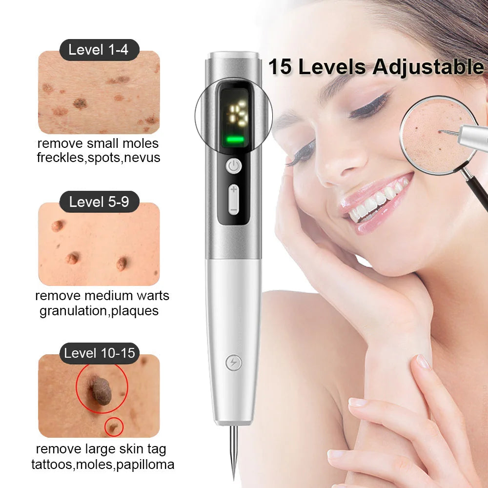 Skin Tag Remover Laser Plasma Pen Dark Spot Mole Wart Remover - 24 Timmar Deals