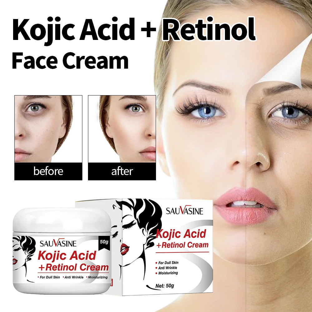 50g Kojic Acid Face Cream + 30ml Facial Serum Fade Dark Spots Brightening Skin Whitening Cream - 24 Timmar Deals