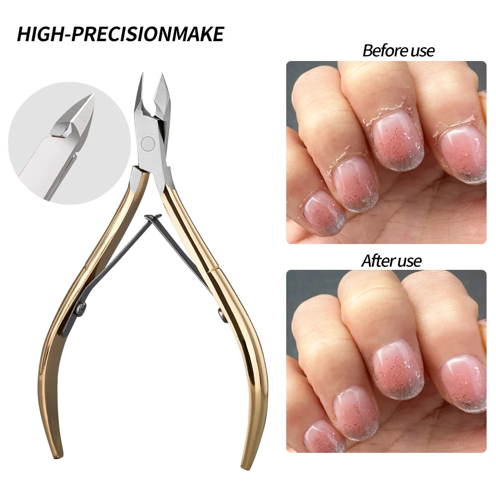 Nail Cutter Nipper Rostfritt stål Dead Skin Remover Tool - 24 Timmar Deals