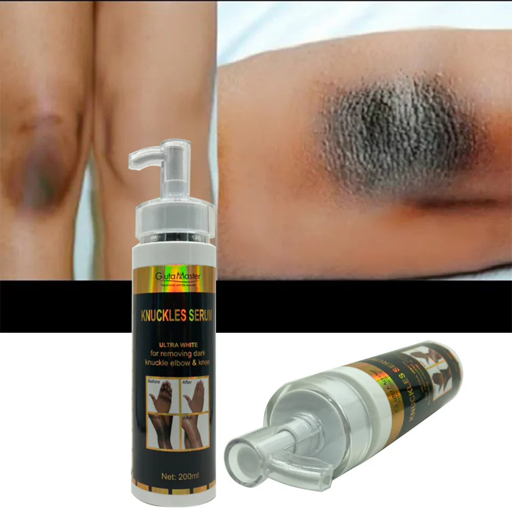 Gluta Master Terminal White Secret Black Skin Knuckles Serum Ultra White för att ta bort mörk Knuckle Armbåge & Knä 200ml - 24 Timmar Deals