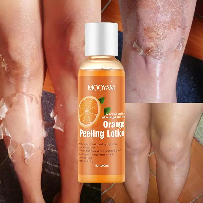 Orange Peeling Mask Lightening Body Face Lotion Strong Whitening Peeling Lotion 100ml - 24 Timmar Deals